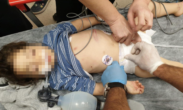 Adana'da üvey annenin komaya soktuğu küçük çocuktan haber var - Resim: 0