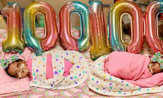 ABD'de mucize gerçekleşti! Doktorların yaşamaz dediği ikizler dünyaya gözlerini açtı - Resim: 1