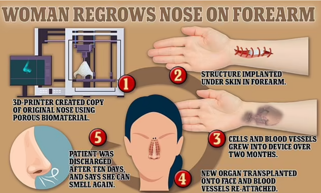 Burnu kolunda yeniden çıktı! Tıp dünyasında çığır açan buluş - Resim: 2