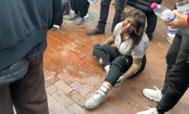 Nazilli’den acı haber! Patlamadan kendi imkanlarıyla böyle kurtulmuştu, genç kız hayatını kaybetti - Resim: 2