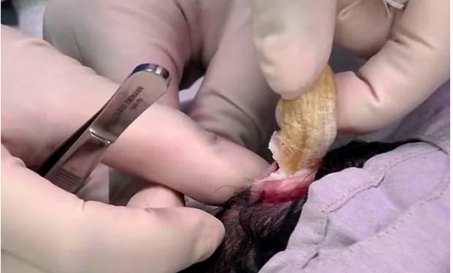 Kafasından boynuz çıktı! Görüntü tıp dünyasını ayaklandırdı! - Resim: 3