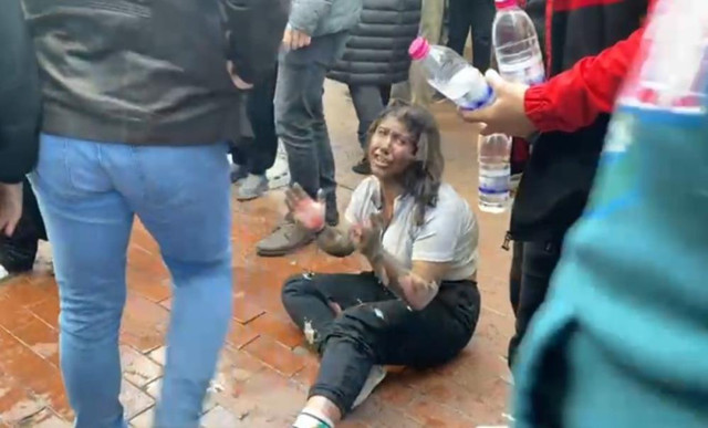 Nazilli’den acı haber! Patlamadan kendi imkanlarıyla böyle kurtulmuştu, genç kız hayatını kaybetti - Resim: 0