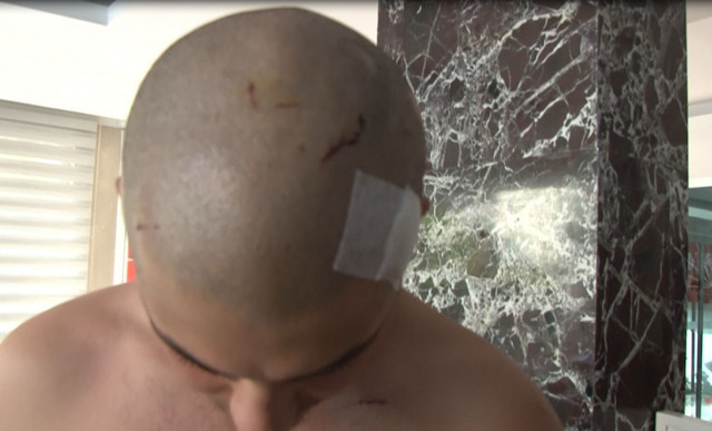 6 kişi tarafından sopalarla ve demir çubukla dövüldü! 'Ahlaksız teklif' iddiasına yanıt - Resim: 1