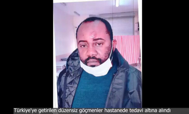 Yunanistan'ın göçmenlere uyguladığı işkence! İçişleri Bakanı Süleyman Soylu paylaştı - Resim: 1