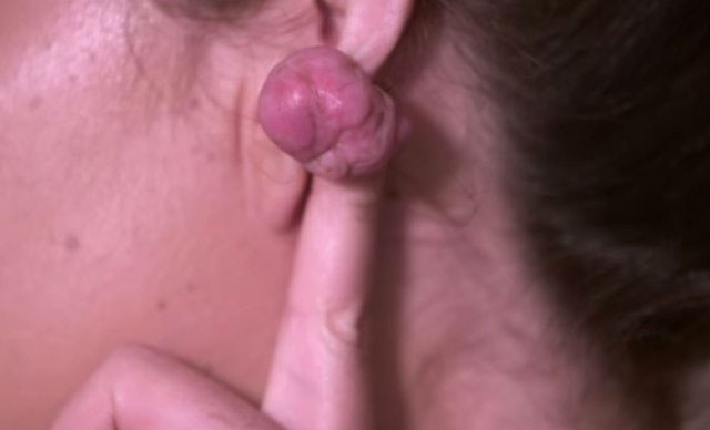 Küpe takmak için kulaklarını deldirdi hayatı zindan oldu - Resim: 2