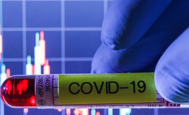 Bilim Kurulu Üyesi Prof. Dr. Alpay Azap: Türkiye kritik olgu eşiği olan 100'e ulaştı - Resim: 0