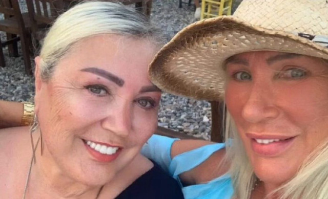 Seda Sayan'dan sonra ablası Nursel Sayan estetik için bıçak altına yattı - Resim: 0