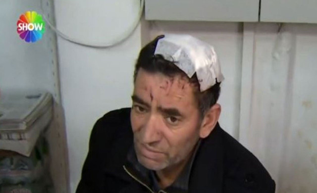 Böylesi daha önce olmadı! Amcasının kafa derisini yüzdü sebebi de... - Resim: 1