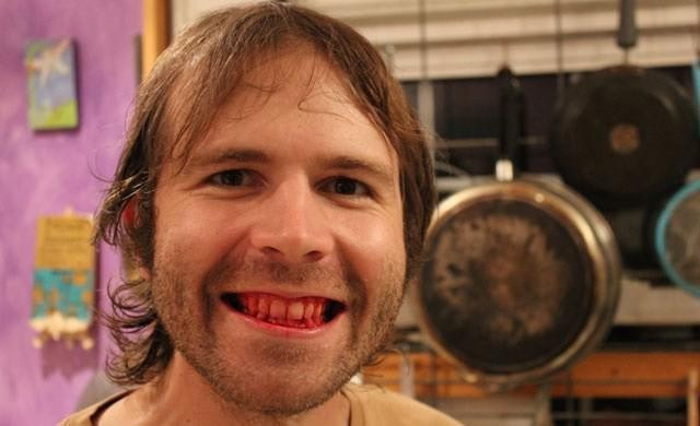 Çiğ et yiyor kan içiyor son 21.yüzyılın vampiri! - Resim: 4