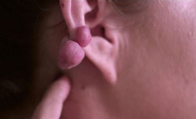 Küpe takmak için kulaklarını deldirdi hayatı zindan oldu - Resim: 4