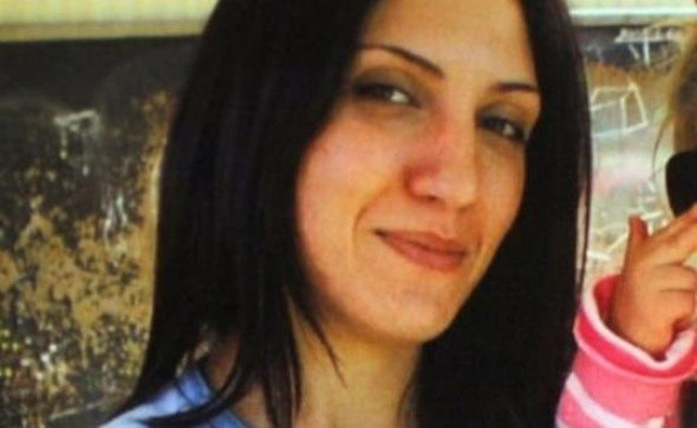 Kıskanç kadın yüzünü bu hale getirdi - Resim: 4