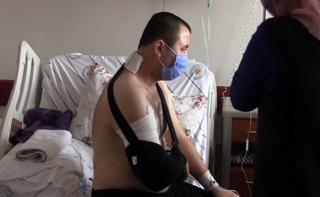 Konya'da torna operatörünün kopan kolu yerine dikildi - Resim: 1