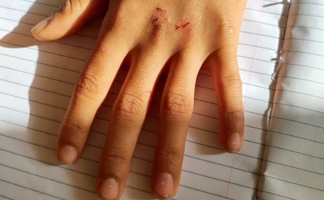 Kemikleri çatlatıyor, kalıcı hasar bırakıyor! Okullardaki yeni tehlike "Kanlı para oyunu" - Resim: 0