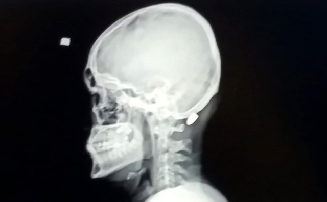 Trabzon'da yaylada gezerken maganda kurşunuyla vuruldu - Resim: 0