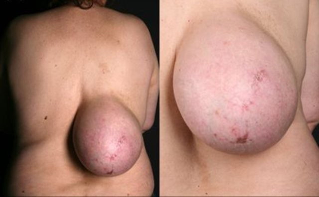 Doktorlar görünce hayrete düştü! Kocaman bir... - Resim: 1