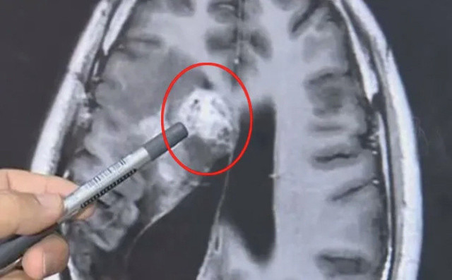 Farkında bile değiliz ama beynimizin içinde dolaşıp duruyormuş! - Resim: 0