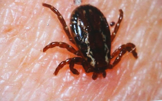 Sivas'ta 1 ayda 50 vaka 3 ölü kabus erken döndü öldürücülüğü Covid’den yüksek - Resim: 0