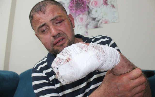 Bursa'da büyük terbiyesizlik gazi olduğunu söylemesine rağmen saldırdılar - Resim: 1