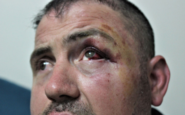 Bursa'da gazimizi öldüresiye darp eden 3 kişi hakkında yeni gelişme! Hak yerini buldu - Resim: 0