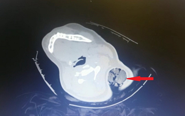 Kahramanmaraş’ta kaza sonrası inanılmaz kurtuluş - Resim: 0