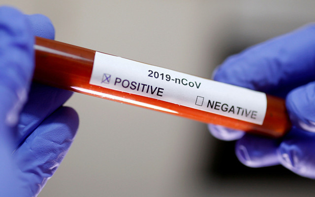 Koronavirüsten ölenlerin sayısı 521’e ulaştı! Çin'den gelen tüm uçuşlar durduruluyor - Resim: 0