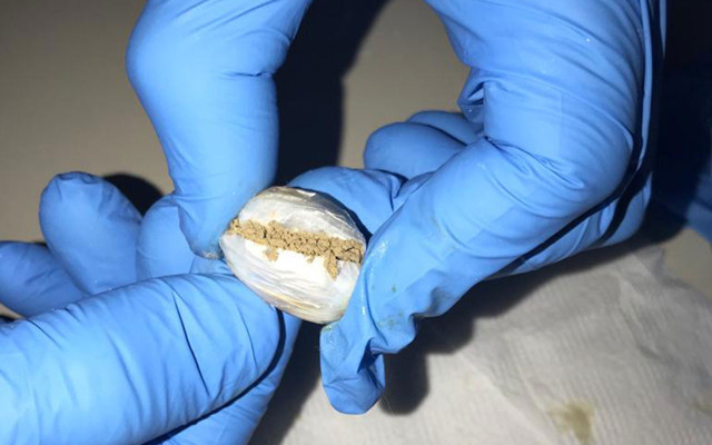 İranlının midesinden çıkan uyuşturucular şaşkınlık yarattı ne ararsan var - Resim: 2