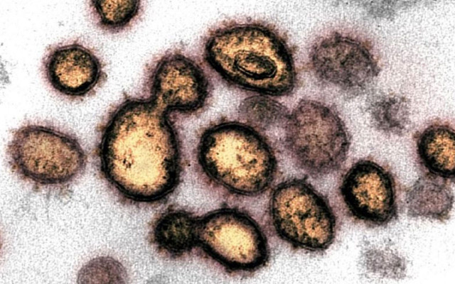 Bilim insanlarından dehşete düşüren koronavirüs keşfi: 40 mutasyon geçirmiş - Resim: 0