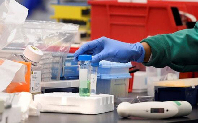 Sonunda koronavirüs aşısı geliştirildi! Bu yıl Ekim’de başlıyor - Resim: 0