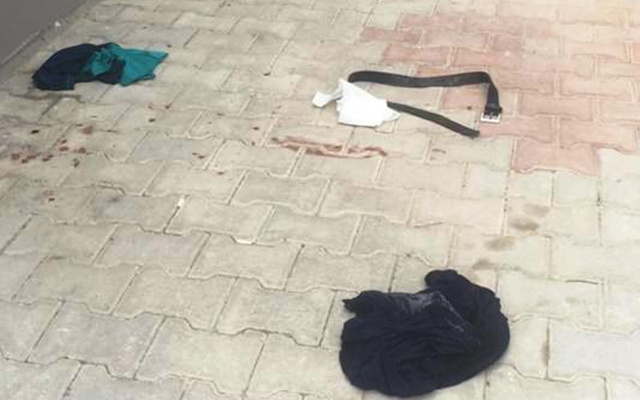 Antalya'da arkadaşını dört yerinden bıçakladı - Resim: 0