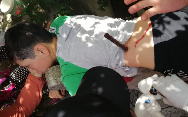 Silivri'de çıktığı ağaçtan düşünce vücuduna demir saplandı - Resim: 0