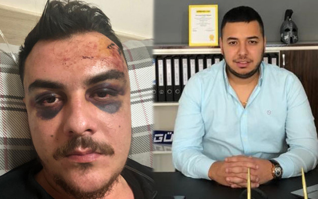 Mersin'de 4 kişi tarafından feci şekilde dövülüp komalık edildi - Resim: 0