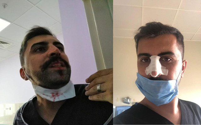 Ağrı'da feci olay! Sosyal mesafe uyarısı yapan hemşirenin burnunu kırdılar - Resim: 0