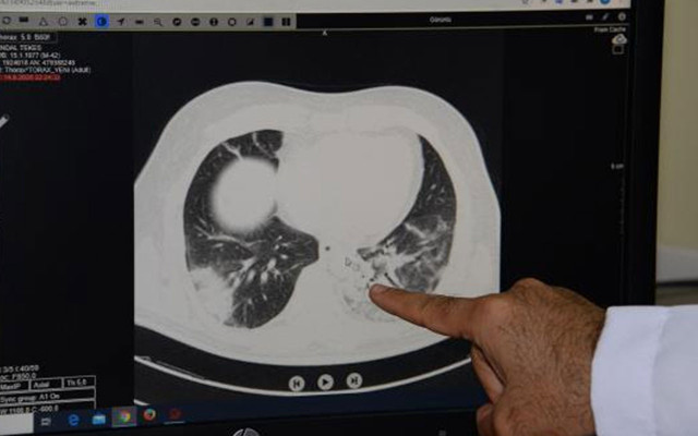 Pandemi hastanesindeki doktor Hakan Akelma: Tanık olduklarımı gören biri evden dışarı çıkmazdı - Resim: 1