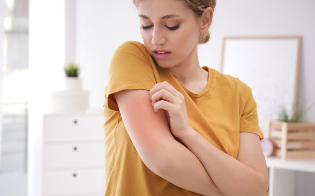 Kişiden kişiye bulaşıyor! Uzmandan uyuz hastalığı uyarısı - Resim: 0