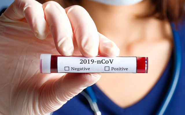 Özel hastanelerde koronavirüs gerçeği! Fazla ücret alınıp test sonuçları girilmemiş - Resim: 0