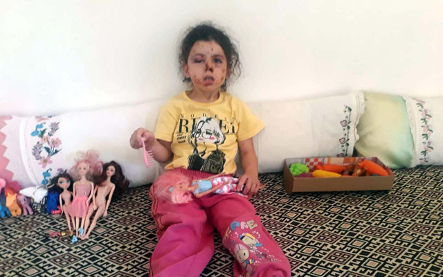 İzmir'de sünnet magandaları küçük kızı bu hale getirdi - Resim: 0