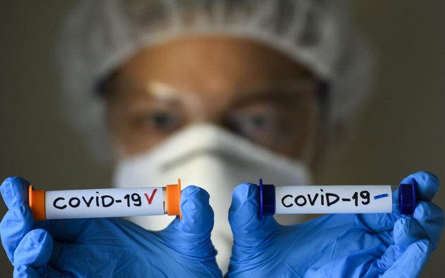 Koronavirüsün mutasyona uğradı! Bir iyi bir kötü haber var - Resim: 0