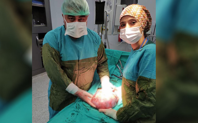 4 kilo ağırlığında futbol topu büyüklüğünde Gaziantep'te dev kitle böyle çıkartıldı - Resim: 0