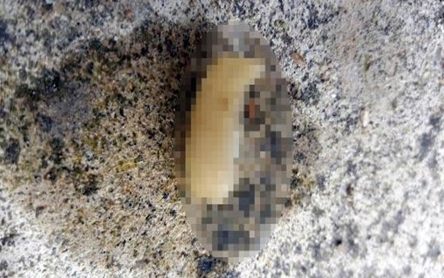 Tekirdağ'da yaşandı! Yediği yemekten insan parmağı çıktı: Psikolojim bozuldu - Resim: 0