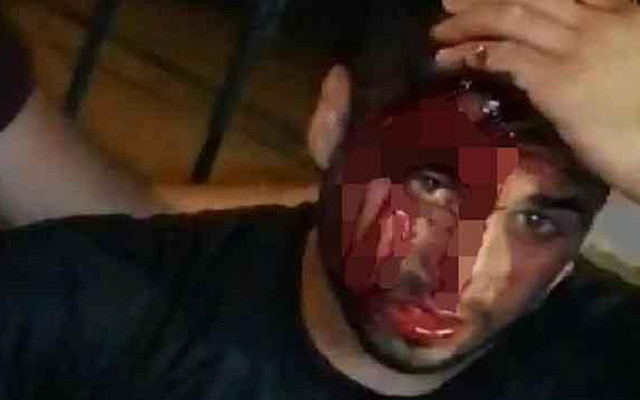 Hatay'da gergin gece! Sigara için çakmağını çaktı ‘kundakçı’ diye dayak yedi - Resim: 0