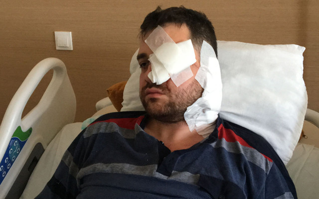 Konya'da bıçaklı saldırıya uğrayan avukat: Saldırgan peruk takmıştı - Resim: 0