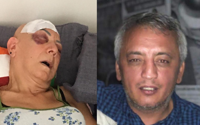 Fatih'te kayınvalidesini 'sülaleni doğrayacağım' deyip bu hale getirdi! Cezası belli oldu - Resim: 0