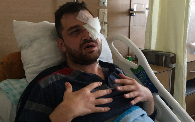 Konya'da avukatı kör eden peruklu saldırgan müvekkilin kocası çıktı - Resim: 0