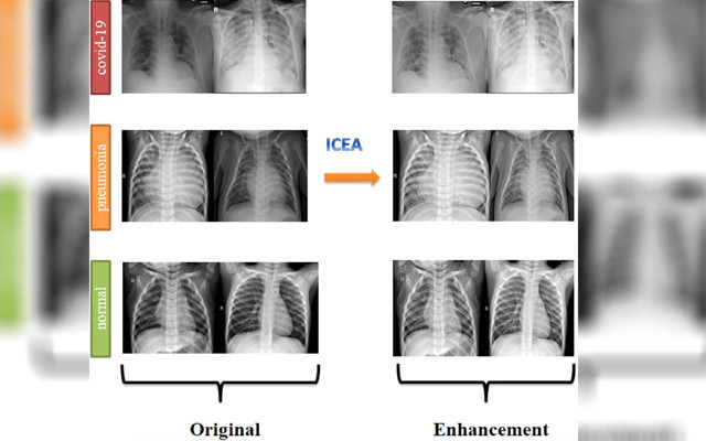 Röntgen filminden saniyeler içinde korona teşhisi yapıyor! Van'da yapay zekayla geliştirdi - Resim: 1