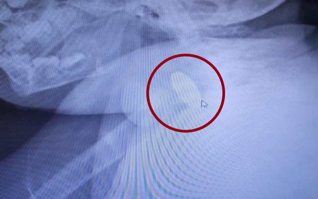 Zonguldak'ta 1 yaşındaki bebek ölümden döndü 25 kuruşluk parayı doktorlar çıkardı - Resim: 1