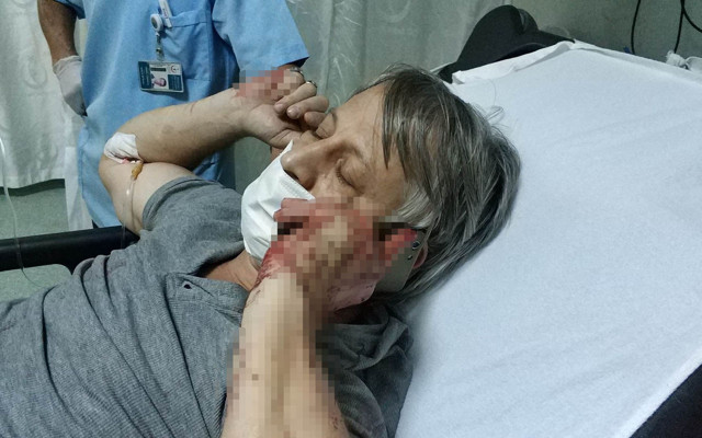 Samsun'da evladın yaptığına bak: 16 yaşında babasını bıçaklayarak ağır yaraladı - Resim: 0