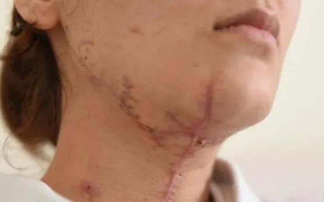 Avcılar'da sevgilisinin boğazını kesip cinsel saldırıda bulunan cani: Olay abartılıyor - Resim: 0