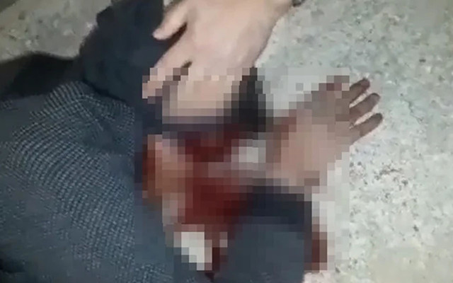 Çorum'da damat dehşetinde vurulan kayınvalide de öldü 3 yaşında çocuk kaçırmış - Resim: 0