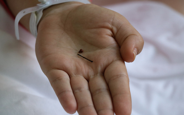 Aydın'da 17 yıllık şok gerçek! Bebekken yuttuğu toplu iğneyle bağırsağı delik yaşadı - Resim: 1