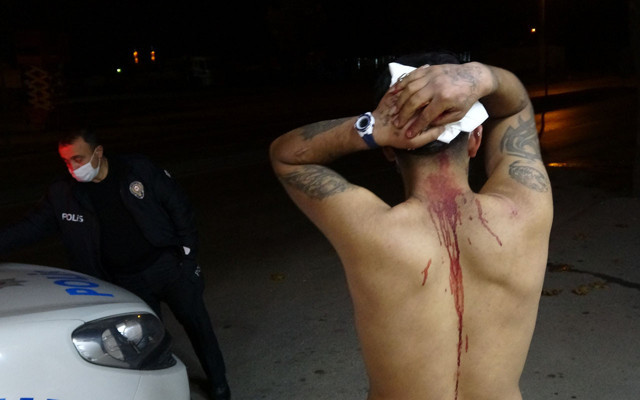 Bursa'da Suriye uyruklu akrabaların tartışmasında çivili sopalı dehşet! - Resim: 0